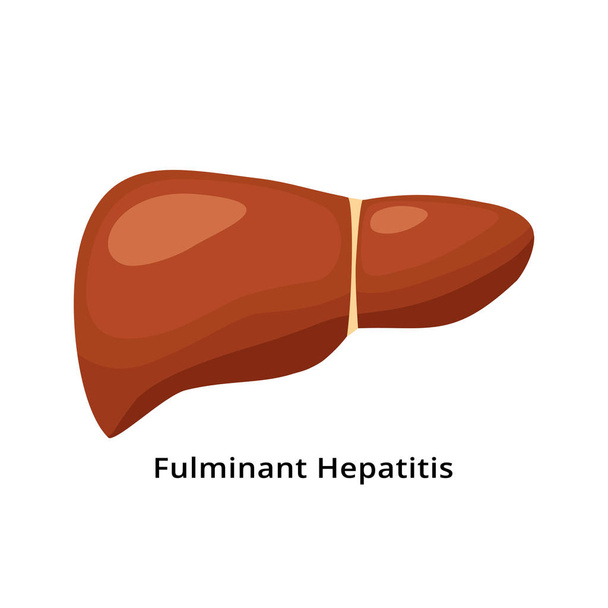 Fulminante Hepatitis-Leber-Ikone isoliert auf weißem Hintergrund. Illustration des Konzepts für Lebererkrankungen in flachem Design. - Vektor, Bild