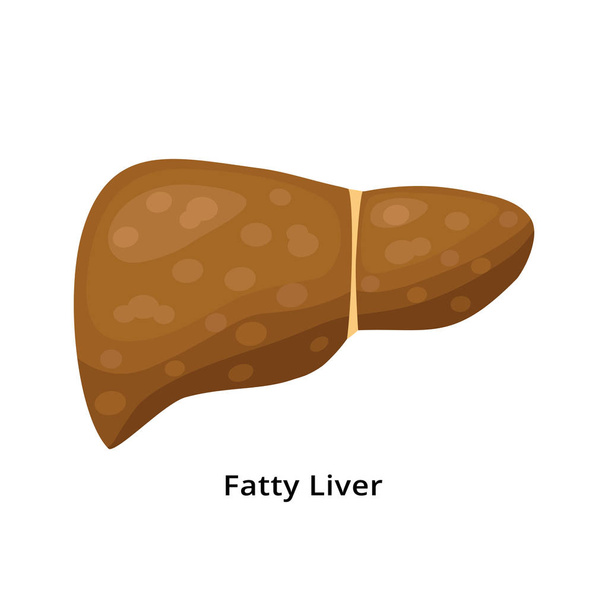 Icono de hígado graso aislado sobre fondo blanco. Ilustración del concepto de enfermedad leve en el diseño plano. - Vector, imagen