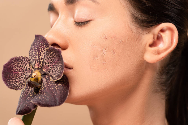 young woman with problem skin smelling orchid isolated on beige  - 写真・画像