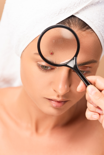 cropped view of man holding magnifier near woman with pimple on face  - Foto, Imagem