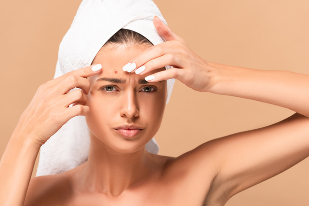 young naked woman in towel squeezing pimple isolated on beige  - Photo, Image