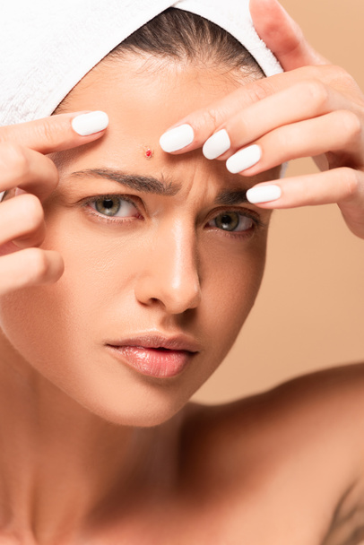 young woman in towel touching face with pimple isolated on beige  - Photo, Image