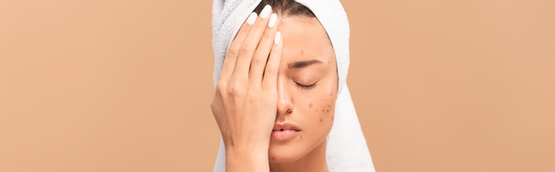 plano panorámico de chica con la cara cubierta de acné aislado en beige
  - Foto, Imagen