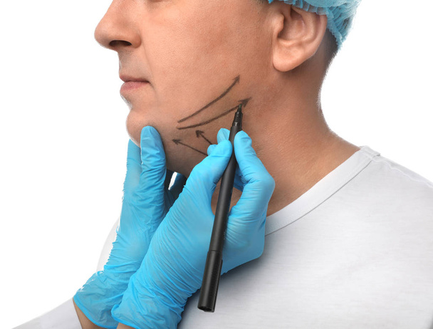 Surgeon with marker preparing man for operation on white backgro - Foto, imagen