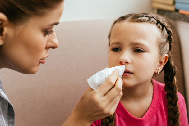 worried mother holding napkin near upset daughter with nasal bleeding - Photo, Image