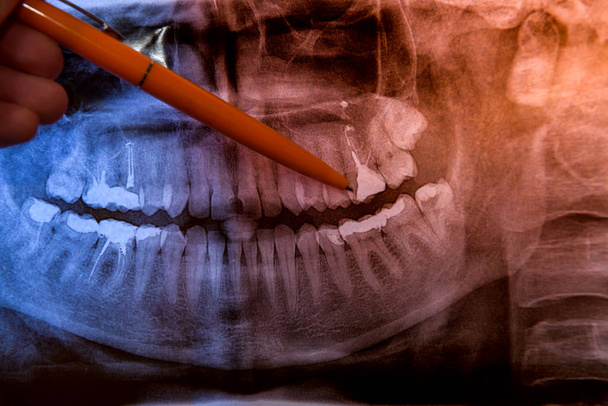 Medico mano con denti raggi X da vicino
 - Foto, immagini
