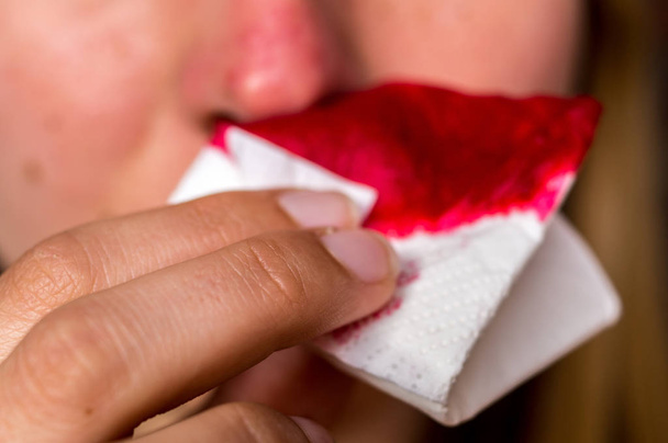 Donna con dettaglio sangue dal naso
 - Foto, immagini