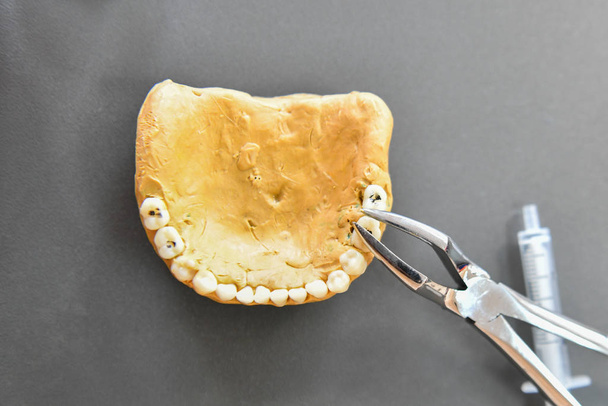 Pry out teeth on the breadboard. Teaching Dentistry. tongs and teeth. toothache. - Photo, Image