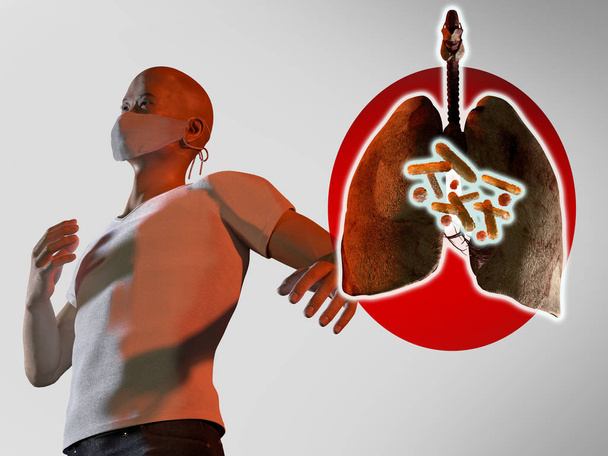 肺炎中国コロナウイルスの概念、 3Dレンダリング - 写真・画像