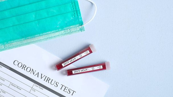 Coronavirus blood test concept. Test tubes with blood of patients for 2019-nCoV analysis and medical form Coronavirus test over laboratory desk. Chinese Wuhan virus outbreak - Zdjęcie, obraz