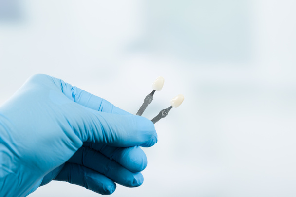 Zbliżenie przewodnika cienia, aby sprawdzić fornir korony zęba w stomatologii - Zdjęcie, obraz