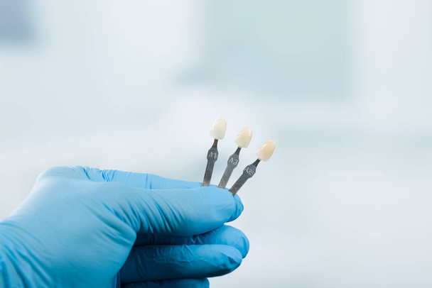 Lähikuva kolme eri sävy opas tarkistaa viilu hampaan kruunu hammaslääketieteen valkaisuun
 - Valokuva, kuva