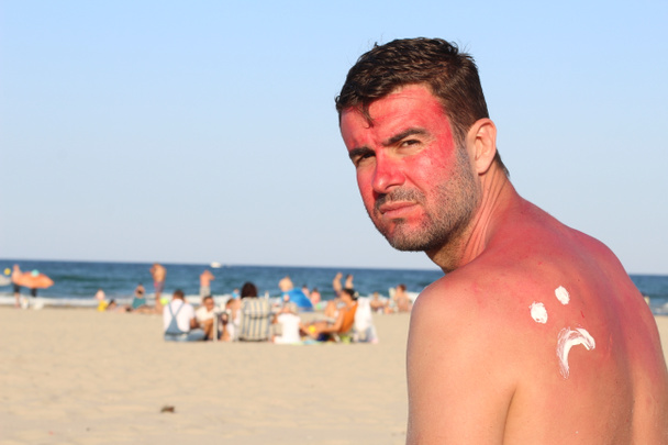 Homem ficando queimado ao sol na praia
 - Foto, Imagem