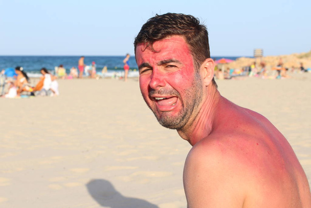 Homem ficando queimado ao sol na praia
 - Foto, Imagem
