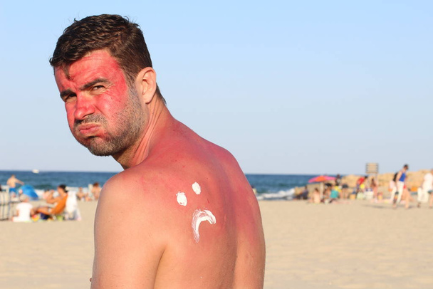 Чоловік загорівся на пляжі
 - Фото, зображення