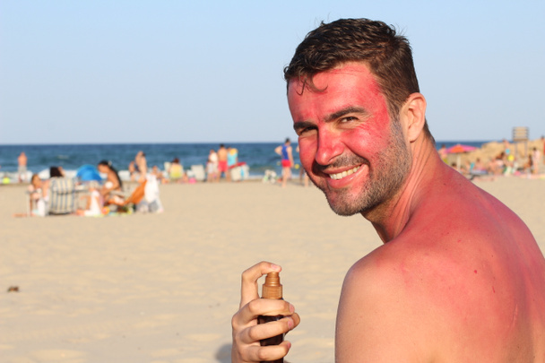 Mann bekommt am Strand Sonnenbrand - Foto, Bild