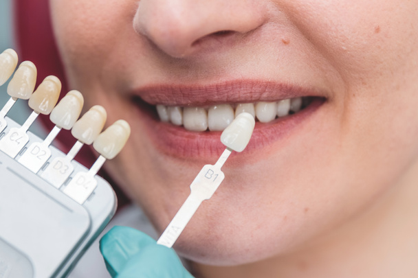 dentysta korzystający z przewodnika cienia przy pięknym uśmiechu żeńskich ust w celu sprawdzenia procesu wybielania zębów lub odcieni implantów, zdrowia zębów i koncepcji pielęgnacji zębów - Zdjęcie, obraz