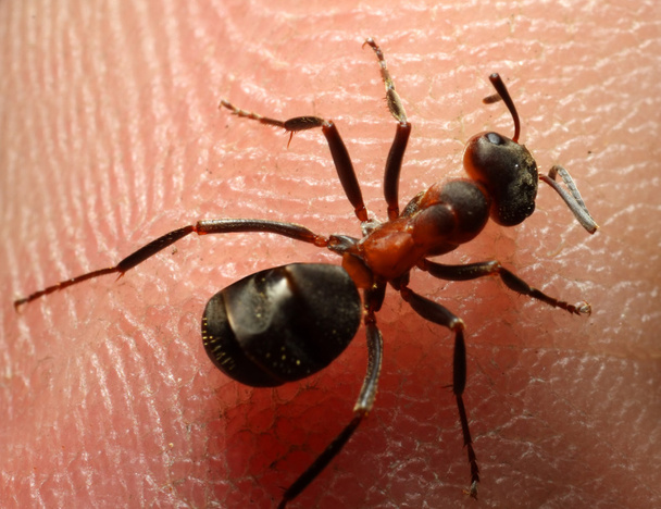 Rote Ameise in der Haut - Foto, Bild