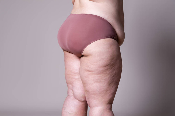 Overweight woman with fat legs and buttocks, obesity female body - Фото, зображення