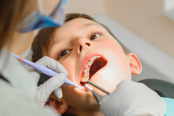 The boy examined by an orthodontist, he opened his mouth wide and the dentist examined his teeth. - Foto, imagen