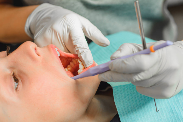 O menino no consultório odontológico, examinando novos dentes e tratando os defeituosos
. - Foto, Imagem