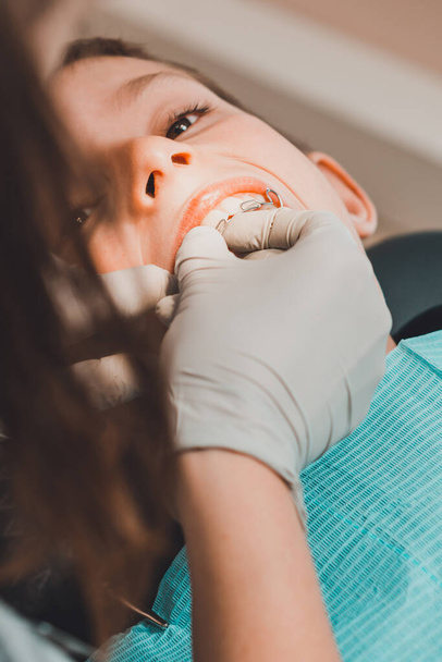 O menino com a boca aberta jaz na cadeira do dentista enquanto o ortodontista segura a placa nos dentes.
. - Foto, Imagem
