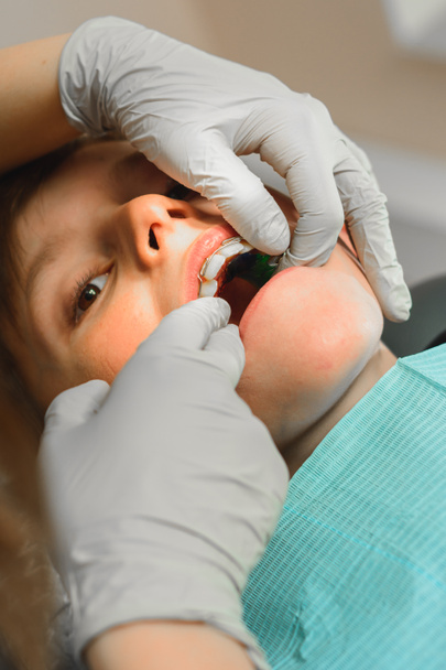 歯医者は歯の上にプレートを保持しながら、彼の口を開いた少年は、歯科医の椅子に横たわっています。. - 写真・画像