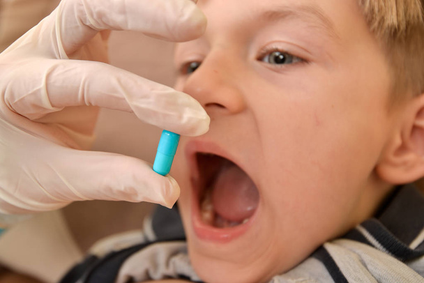 ein Arzt in medizinischen Handschuhen hält eine blaue Kapsel mit Medikamenten, ein Kind mit offenem Mund wartet auf eine Pille zur Behandlung der Krankheit. - Foto, Bild