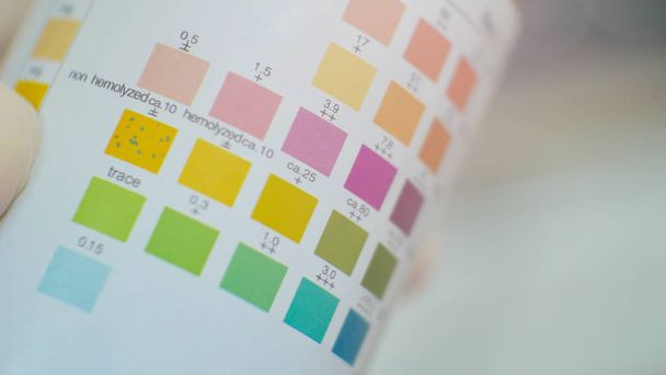 Fermer le niveau de couleur dans le test de bande d'urine
. - Photo, image