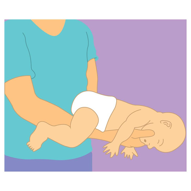 Cómo dar primeros auxilios a los recién nacidos en caso de atragantamiento
 - Vector, Imagen