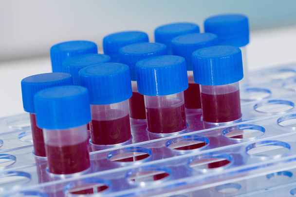 blood samples in a tube rack - Photo, image