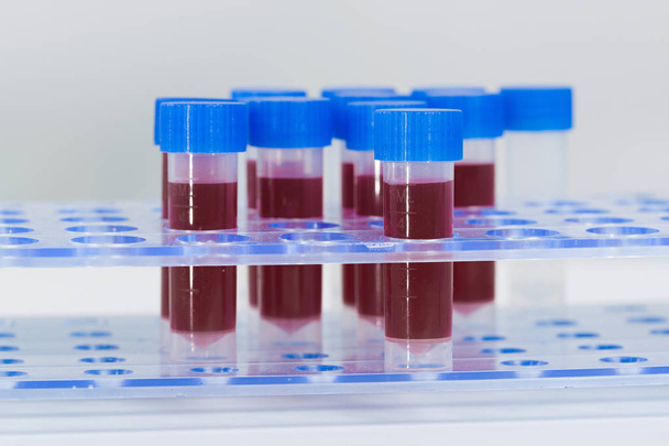blood samples in a tube rack - Photo, Image