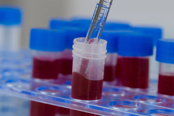 amostras de sangue e uma pipeta em um rack de tubo
 - Foto, Imagem