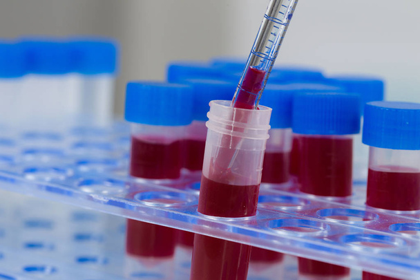 working with blood samples in a tube rack - Photo, Image