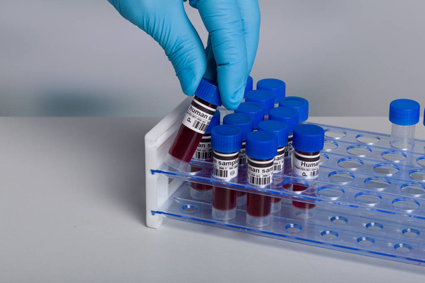 main dans les gants médicaux obtenir échantillon de sang humain d'un support à tubes
 - Photo, image