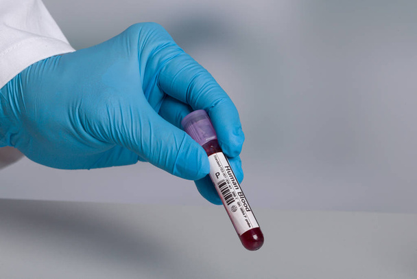 échantillons de sang humain dans un support à tubes
 - Photo, image