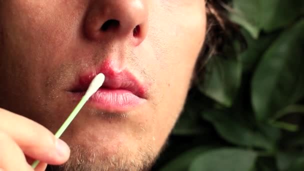 Tratamento de herpes sobre o lábio com um creme especial
 - Filmagem, Vídeo