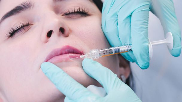 Kozmetikus kezek botox injekciót készítenek női ajkakon. A dokk - Fotó, kép