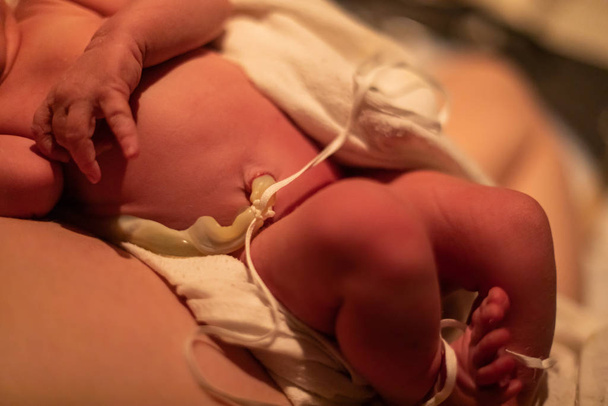 Sujeción del cordón umbilical después del nacimiento
 - Foto, Imagen