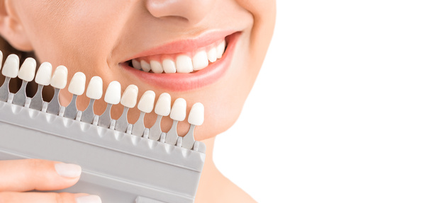 Όμορφο χαμόγελο και λευκά δόντια μιας νεαρής γυναίκας. Συνδυάζοντας τις αποχρώσεις των εμφυτευμάτων ή τη διαδικασία λεύκανσης δοντιών. - Φωτογραφία, εικόνα