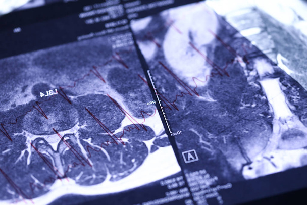 MRI image lying over cardiogram chart - Photo, Image