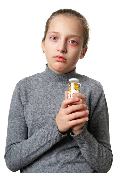 Reakcja alergiczna, wysypka skórna, portret twarzy dziewczyny. Zaczerwienienie i zapalenie skóry w oczach i ustach. Choroba układu odpornościowego. Butelka tabletek i tabletek w rękach dziecka. - Zdjęcie, obraz