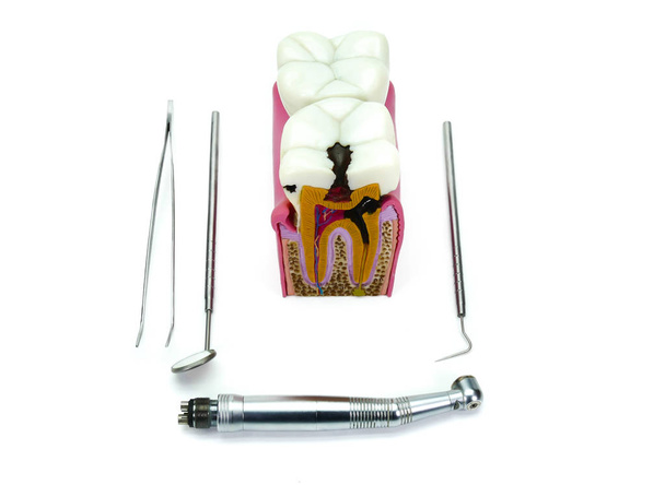 Modelo de dientes con caries dental, abscesos e instrumentos de dentista, kit de herramientas: turbina, espejo, sonda, pinzas
 - Foto, Imagen