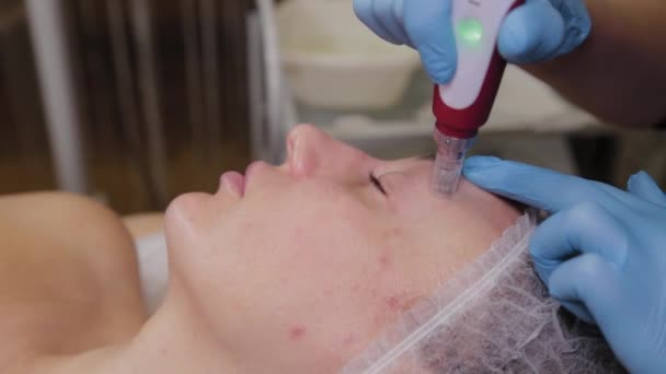 Professional beautician woman performs micronidling facial skin. - Video, Çekim