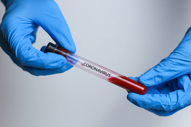 Concepto de análisis de sangre por Coronavirus. Médico mano en guante médico blanco sosteniendo tubo de prueba con Coronavirus sangre positiva en el laboratorio. 2019-nCoV Coronavirus originario de Wuhan, China
 - Foto, Imagen