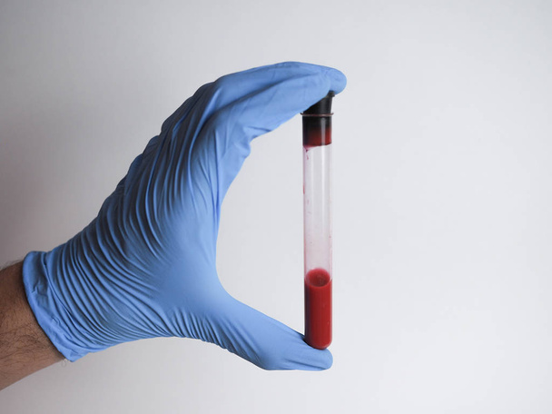 青い手袋を身に着けている科学者はコロナウイルス検査のための血液検査管を持っています - 写真・画像