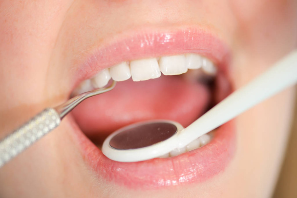 Dentist looking into a woman's mouth - Zdjęcie, obraz