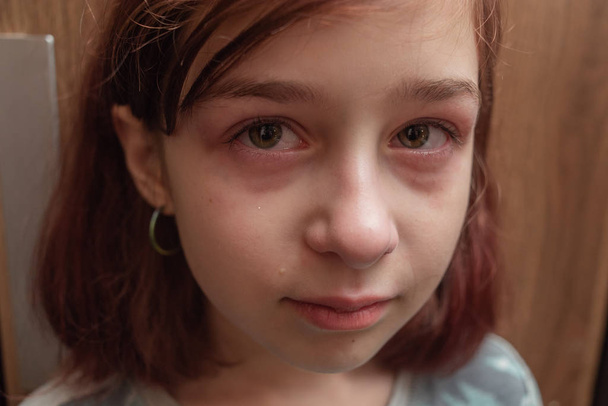 Muotokuva pikkutytöstä, joka itkee kyyneleet poskillaan. Tyttö 9 vuotta caret haircut on järkyttynyt
 - Valokuva, kuva