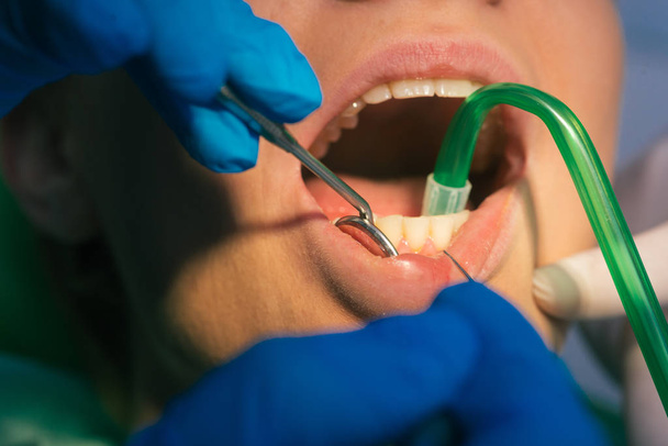 Чистый стоматологический осмотр зубов женщины в стоматологическом кабинете - Фото, изображение