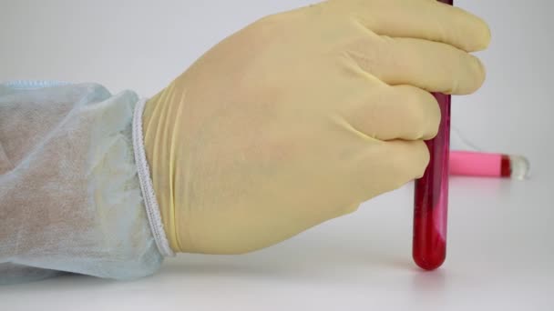 Hand met bloedmonster in vacuümbuis. Positieve testresultaten voor het nieuwe snel verspreidende Coronavirus - Video